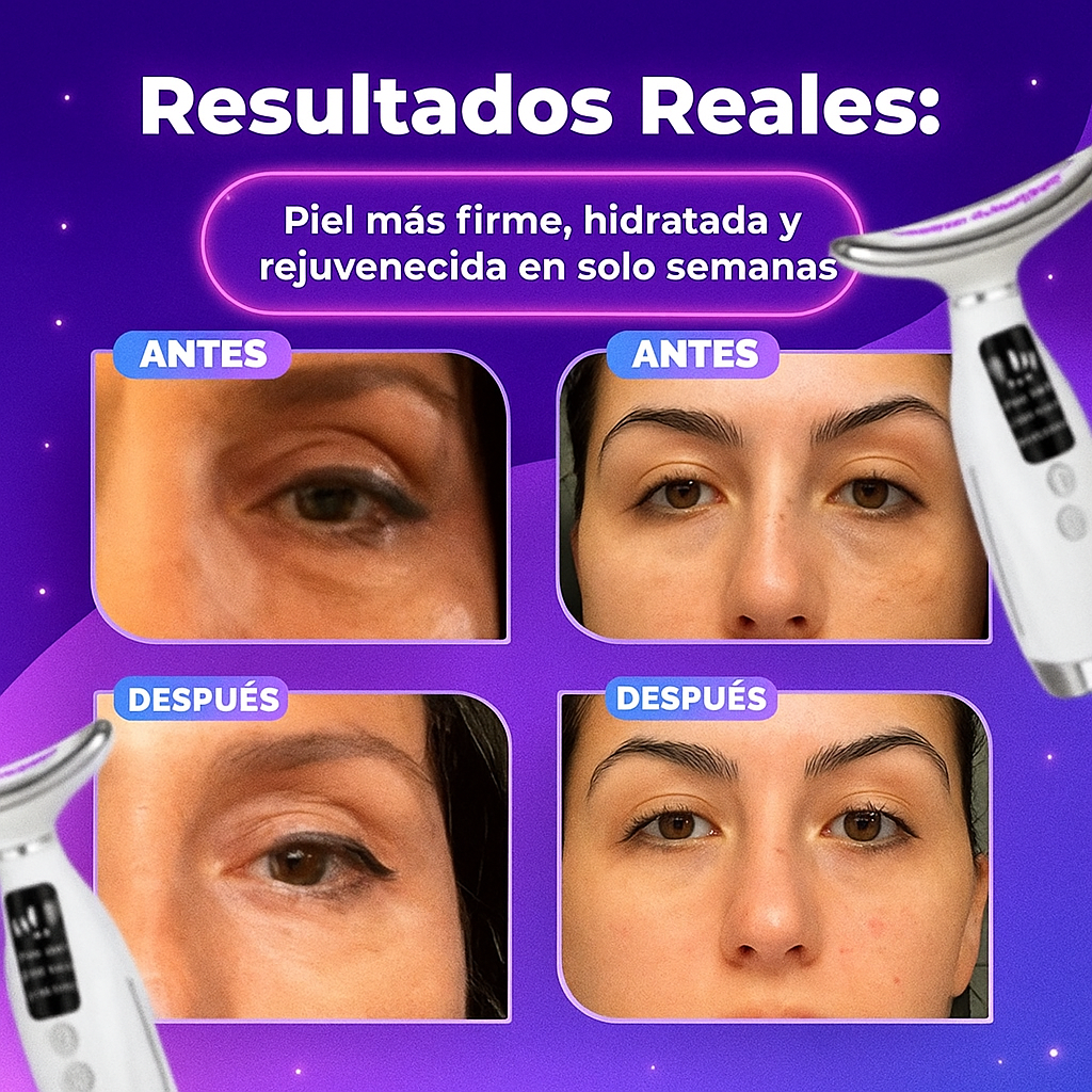 MASAJEADOR FACIAL PRO-GLOWLIFT™ 💎 + SÉRUM DE ÁCIDO HIALURÓNICO🎁