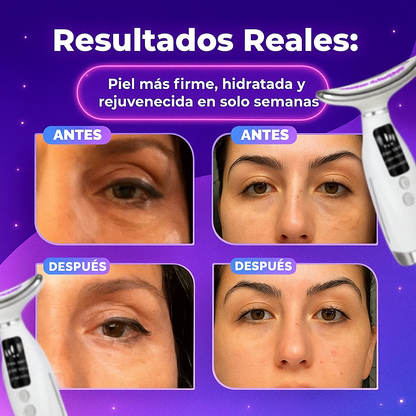 MASAJEADOR FACIAL PRO-GLOWLIFT™ 💎 + SÉRUM DE ÁCIDO HIALURÓNICO🎁